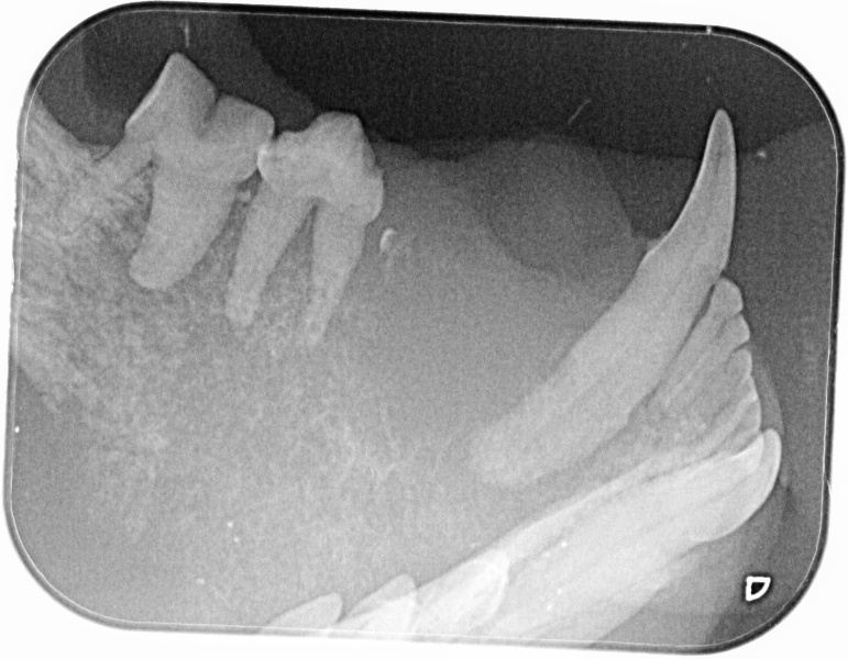 Osteolyse und Osteoproliferation - Zwei apokalyptische Reiter der Röntgendiagnostik